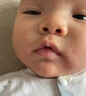【全面守護兒童肌膚】嬰幼兒濕疹皮炎藥膏藥用頁(yè)巖油皮膚瘙癢傷口快速愈合護理祛疤 曬單實(shí)拍圖