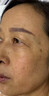 YYTISS377美白祛斑霜官方正品淡化祛斑美白淡斑黑色素去雀斑黃褐斑女士 曬單實(shí)拍圖