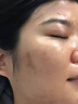 臉上黑色素沉淀去除臉部排毒排黑色素去黑斑點(diǎn)去黑色素臉部醫用皮膚色素暗沉痘印曬斑淡斑美白熊果苷軟膏 單盒裝【免費試用】 曬單實(shí)拍圖