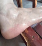 潤濟康腳后跟干裂起硬皮足跟開(kāi)裂口防皸裂膏腳底手足干燥脫皮滋潤護手霜 1盒裝【體驗裝】 曬單實(shí)拍圖