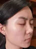 點(diǎn)痣膏無(wú)痕正品臉部點(diǎn)痦子取痣去黑痣專(zhuān)用點(diǎn)痣藥水神器儀黑點(diǎn)去除 去黑痣*1 曬單實(shí)拍圖