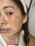 YYTISS377美白祛斑霜官方正品淡化祛斑美白淡斑黑色素去雀斑黃褐斑女士 曬單實(shí)拍圖