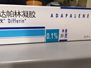 【原研好藥】達芙文 阿達帕林凝膠0.1%*30g*2盒 祛痘藥膏去黑頭粉刺丘疹和膿皰淡化痘坑痘印輕中度尋常型痤瘡 曬單實(shí)拍圖