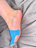 ARUKUMARU德國拇指外翻矯正器腳趾拇外翻繃帶肌肉貼大腳趾外翻矯正糾正肌貼 藍色【40只裝】 均碼 曬單實(shí)拍圖