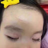 御夫清美國進(jìn)口疤克巴克祛疤膏兒童去疤痕修復凝膠小孩專(zhuān)用除去疤膏手術(shù) 曬單實(shí)拍圖