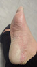 成田制藥 足光散 40g*3袋*5盒 清熱燥濕，殺蟲(chóng)斂汗，用于濕熱下注所致的角化型手足癬及臭汗癥 曬單實(shí)拍圖