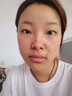 MEROYDOCTOR去痣點(diǎn)痣膏正品點(diǎn)痣無(wú)痛無(wú)痕祛痣黑痣臉部去痣祛斑專(zhuān)用不留疤痕 曬單實(shí)拍圖