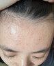 LD氨基酸洗面奶祛痘印痘坑收縮毛孔去角質(zhì)美白淡斑提亮膚色去黃女男 1瓶裝【控油祛痘】氨基酸清肌潔面乳 200g/瓶 曬單實(shí)拍圖