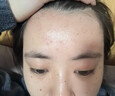 LD氨基酸洗面奶祛痘印痘坑收縮毛孔去角質(zhì)美白淡斑提亮膚色去黃女男 1瓶裝【控油祛痘】氨基酸清肌潔面乳 200g/瓶 曬單實(shí)拍圖