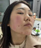 同仁堂祛痘膏去痘痘和痘印痘坑修復男女士改善粉刺閉口30g 曬單實(shí)拍圖