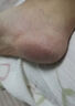 李福記手足皸裂膏腳后跟干裂口足跟粗糙干燥專(zhuān)用防止手足干裂脫皮凍瘡膏 100g 1瓶 皮膚干燥 曬單實(shí)拍圖