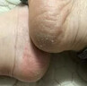 GTHIELY德國進(jìn)口馬油膏手足裂干裂馬油防裂膏保濕修復裂口男女腳后跟專(zhuān)用 1罐應急裝 曬單實(shí)拍圖