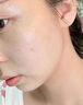 維特絲愈創(chuàng  )木祛痘精華淡化痘印去痘痘收毛孔男女士護膚品青春期學(xué)生專(zhuān)用 曬單實(shí)拍圖