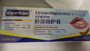 KEORKAO唇炎專(zhuān)用慢性唇炎嘴唇干裂醫用級脫皮兒童三草油潤唇膏男女士藥膏 曬單實(shí)拍圖