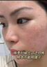 韓方五谷壬二酸祛痘藥膏祛痘淡化痘印煙酰胺凝膠水楊酸膠態(tài)硫青春期學(xué)生 曬單實(shí)拍圖