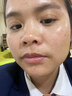 SKISGEM德國進(jìn)口美白祛斑面霜男女士淡化黑色素提亮補水保濕水乳護膚套裝 【源頭祛斑：急救斑點(diǎn)肌】美白保濕面霜30ml 曬單實(shí)拍圖