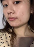 維特絲壬二酸祛痘膏煙酰胺凝膠去痘痘淡痘印水楊酸膠態(tài)硫青春期學(xué)生專(zhuān)用 曬單實(shí)拍圖