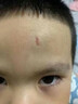 御夫清美國進(jìn)口疤克巴克祛疤膏兒童去疤痕修復凝膠小孩專(zhuān)用除去疤膏手術(shù) 曬單實(shí)拍圖
