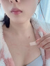 OURHEAL疤痕貼剖腹產(chǎn)醫用美皮膚祛疤痕專(zhuān)用修復護增生凸起疙瘩硅酮減張貼 曬單實(shí)拍圖