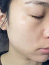 泊紫汀蘭壬二酸祛痘膏淡化痘印痘坑去閉口粉刺男女士學(xué)生青春痘水楊酸面霜 曬單實(shí)拍圖