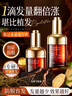 維特絲育發(fā)液防脫育發(fā)固發(fā)養發(fā)男女生姜頭皮護理側柏葉何首烏精華液 曬單實(shí)拍圖