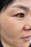 透真377美白祛斑淡化黑色素雀斑抗皺緊致淡紋面部玫瑰精華油去黃次拋 曬單實(shí)拍圖