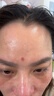 HDGX去痣點(diǎn)痣膏祛痣點(diǎn)疣正品專(zhuān)用無(wú)痛無(wú)痕可搭醫用藥水用藥臉部不留疤 曬單實(shí)拍圖