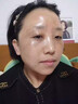 臉上黑色素沉淀去除臉部排毒排黑色素臉上黑印淡化色素沉著(zhù)結痂黑印痘印曬斑淡斑美白修復 一盒體驗裝 曬單實(shí)拍圖