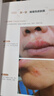 皮膚性病診斷圖譜 曬單實(shí)拍圖