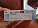 999 阿達帕林凝膠0.1*21g維a酸乳膏第三代祛痘膏去閉口粉刺痤瘡祛痘凝膠青春痘丘疹膿皰痘印坑修復暗瘡藥膏,去粉刺,尋常型痤瘡,輕中度尋常型痤瘡,毛囊炎 曬單實(shí)拍圖