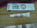 DR.MICKEY制藥祛去疣體脫落膏扁平疣專(zhuān)用跖疣尖銳濕絲狀疣瘊靈脖子肉粒頸部 曬單實(shí)拍圖