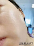 MEROYDOCTOR去痣點(diǎn)痣膏正品點(diǎn)痣無(wú)痛無(wú)痕祛痣黑痣臉部去痣祛斑專(zhuān)用不留疤痕 曬單實(shí)拍圖