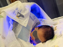 益泰醫用藍光燈新生兒黃疸治療儀去黃藍光治療儀嬰兒寶寶家用烤黃儀 曬單實(shí)拍圖