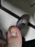 華林堂灰指甲專(zhuān)用指甲增厚發(fā)黃變厚用什么藥好的快重度感染日本原裝進(jìn)口 一盒裝【體驗款】 治灰甲神器無(wú)需拔甲 曬單實(shí)拍圖