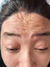 施逅川字紋去除神器去皺紋去法令紋抬頭紋膠原蛋白抗皺額頭貼男女重度 8盒裝【80貼】97%顧客選擇 曬單實(shí)拍圖