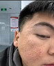 痘印痘坑修復凹洞祛痘去痘印去閉口粉刺去黑頭痘坑男士祛痘疤膏藥 (發(fā)貨特效)買(mǎi)2送1【痘坑痘印凹洞】可試用 去痘痘和痘印淡化消除填充再生凝膠生長(cháng)因子女男生醫用 曬單實(shí)拍圖