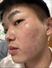 同仁堂祛痘消炎痤瘡專(zhuān)用青少年乳膏藥青春痘粉刺硬疙瘩修復消炎去除痘印 一盒裝(發(fā)貨特效快) 曬單實(shí)拍圖