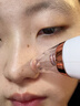 奧克斯（AUX）黑頭儀吸出器去黑頭清理神器吸黑頭面部鏟粉刺清潔小氣泡美容儀三八女神節生日禮物女實(shí)用 曬單實(shí)拍圖
