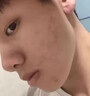 櫻椿焓兒童額頭祛痘藥膏青春痘青少年閉口粉刺克星臉上長(cháng)小疙瘩顆粒痤瘡 特效單盒裝【50g】 逆光疹修復皮膚屏障額頭小顆粒 曬單實(shí)拍圖