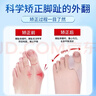 FIT MOMENT大拇指外翻矯正器醫用腳趾矯正器成人兒童腳趾頭分趾器硅膠可穿鞋 曬單實(shí)拍圖