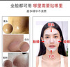 如薇去黑頭鼻貼2盒10組免撕拉面膜導出精華液粉刺收縮毛孔女神節 曬單實(shí)拍圖