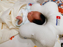 Hoag（霍格）嬰兒定型枕糾正頭型0-6-12月矯正新生兒寶寶枕頭護頸神器 雙面白色+【涼.暖雙面枕套】 【10A級抗菌防螨】 曬單實(shí)拍圖