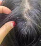 TJHK煤焦油洗劑洗發(fā)水持久去屑止癢控油蓬松毛囊脂溢性馬拉色菌男女士 曬單實(shí)拍圖