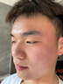 儒意（RUYI）壬二酸祛痘藥膏凝膠態(tài)硫修復淡化痘印水楊酸學(xué)生青春痘痤瘡青少年 曬單實(shí)拍圖