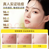 斐思妮祛痘控油膠態(tài)硫調理?yè)崞介]口急救祛痘面膜男女改善泛紅新年禮物 【1盒】輕度痤瘡 改善泛紅 曬單實(shí)拍圖