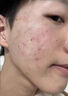 泊紫汀蘭男士面膜控油祛痘去黑頭收縮毛孔淡化痘印抗皺緊致抗衰老補水保濕 曬單實(shí)拍圖