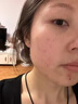井次制藥祛痘膏去痘痘青春痘淡化痘印修復痘疤初高中男女學(xué)生閉口粉刺痤瘡 曬單實(shí)拍圖
