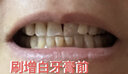 高露潔（Colgate）速感白美白牙膏去煙漬去黃去口臭亮白男士女士進(jìn)口85g*2 包裝隨機 曬單實(shí)拍圖