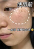 YYTISS377美白祛斑霜官方正品煙酰胺祛斑美白淡化黑色素去黃褐雀斑曬斑 曬單實(shí)拍圖