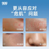 999 阿達帕林凝膠0.1*21g維a酸乳膏第三代祛痘膏去閉口粉刺痤瘡祛痘凝膠青春痘丘疹膿皰痘印坑修復暗瘡藥膏,去粉刺,尋常型痤瘡,輕中度尋常型痤瘡,毛囊炎 曬單實(shí)拍圖